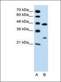 Anti-CLDN18 affinity isolated antibody