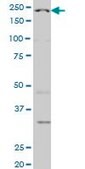 Monoclonal Anti-WRN antibody produced in mouse clone 3C11, purified immunoglobulin, buffered aqueous solution