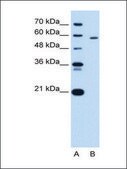 Anti-PKLR antibody produced in rabbit IgG fraction of antiserum