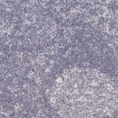 Anti-KIAA1210 antibody produced in rabbit Prestige Antibodies® Powered by Atlas Antibodies, affinity isolated antibody, buffered aqueous glycerol solution