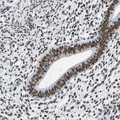 Anti-FUBP1 antibody produced in rabbit Prestige Antibodies® Powered by Atlas Antibodies, affinity isolated antibody, buffered aqueous glycerol solution