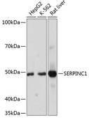 Anti-SERPINC1 antibody produced in rabbit