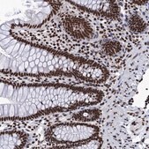 Anti-UBA2 antibody produced in rabbit Prestige Antibodies® Powered by Atlas Antibodies, affinity isolated antibody, buffered aqueous glycerol solution