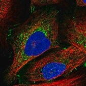Anti-AFDN antibody produced in rabbit Prestige Antibodies® Powered by Atlas Antibodies, affinity isolated antibody, buffered aqueous glycerol solution, ab4