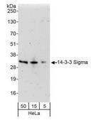 Rabbit anti-14-3-3 Sigma Antibody, Affinity Purified Powered by Bethyl Laboratories, Inc.
