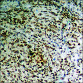 Anti-phospho-BAD (pSer91/128) antibody produced in rabbit affinity isolated antibody