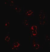 Anti-CXCR4 antibody produced in rabbit affinity isolated antibody