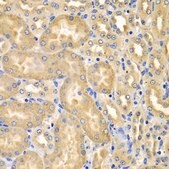 Anti-XIAP antibody produced in rabbit