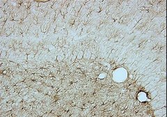 Anti-Glial Fibrillary Acidic Protein Antibody, clone GA5 clone GA5, Chemicon®, from mouse