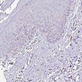 Anti-CYBB antibody produced in rabbit Prestige Antibodies® Powered by Atlas Antibodies, affinity isolated antibody, buffered aqueous glycerol solution