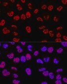Anti-p53 antibody produced in rabbit