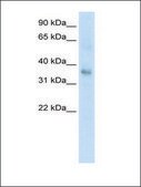 Anti-TGFB1 affinity isolated antibody