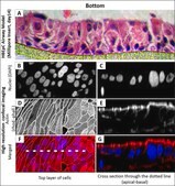 Human Bronchial Epithelial Cells: HBEpC, adult