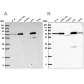 Anti-GBE1 antibody produced in rabbit Prestige Antibodies® Powered by Atlas Antibodies, affinity isolated antibody, buffered aqueous glycerol solution