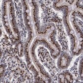 Anti-GOLIM4 antibody produced in rabbit Ab2, Prestige Antibodies® Powered by Atlas Antibodies, affinity isolated antibody, buffered aqueous glycerol solution