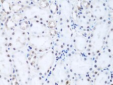 Anti- Histone H2B antibody produced in rabbit