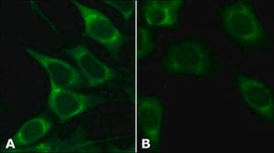 Anti-GRP78/BiP (ET-21) antibody produced in rabbit IgG fraction of antiserum, buffered aqueous solution