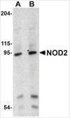 Anti-NOD2 (ab2) antibody produced in rabbit affinity isolated antibody, buffered aqueous solution