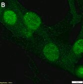 Anti-S100A4 Antibody, clone 1G2 ZooMAb® Rabbit Monoclonal recombinant, expressed in HEK 293 cells
