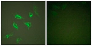 Anti-14-3-3 ζ antibody produced in rabbit affinity isolated antibody