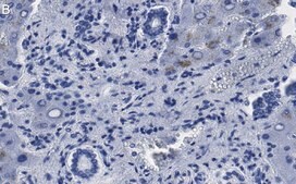 Anti-MeCP2 Antibody, clone 1L20 ZooMAb® Rabbit Monoclonal recombinant, expressed in HEK 293 cells