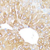 Anti-CYP3A4 antibody produced in rabbit