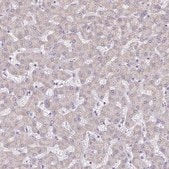Anti-PGAM2 antibody produced in rabbit Prestige Antibodies® Powered by Atlas Antibodies, affinity isolated antibody, buffered aqueous glycerol solution