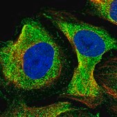 Anti-NDUFAF1 antibody produced in rabbit Prestige Antibodies® Powered by Atlas Antibodies, affinity isolated antibody, buffered aqueous glycerol solution