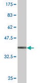 Monoclonal Anti-CBS, (N-terminal) antibody produced in mouse clone 6B8, purified immunoglobulin, buffered aqueous solution