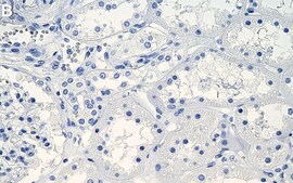 Anti-EBP/NHERF-1 Antibody, clone 1G10 ZooMAb® Rabbit Monoclonal recombinant, expressed in HEK 293 cells