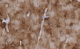 Anti-Desmin Antibody, clone 1H16, ZooMAb® Rabbit Monoclonal recombinant, expressed in HEK 293 cells