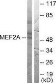 Anti-MEF2A antibody produced in rabbit affinity isolated antibody
