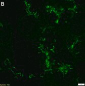 Anti-ROR2 clone XBR2-401 ZooMAb® Rabbit Monoclonal recombinant, expressed in HEK 293 cells