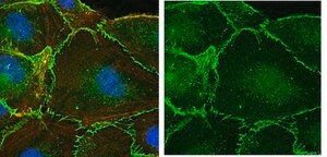Anti-β-Catenin Antibody Upstate®, from rabbit