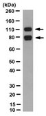 Anti-Progesterone Receptor A/B Antibody, clone 488/H3 clone 488/H3, from mouse