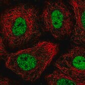 Anti-TGIF1 antibody produced in rabbit Prestige Antibodies® Powered by Atlas Antibodies, affinity isolated antibody