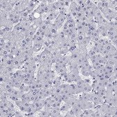 Anti-KCNH1 antibody produced in rabbit Prestige Antibodies® Powered by Atlas Antibodies, affinity isolated antibody, buffered aqueous glycerol solution