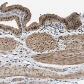 Anti-MED21 antibody produced in rabbit Prestige Antibodies® Powered by Atlas Antibodies, affinity isolated antibody, buffered aqueous glycerol solution