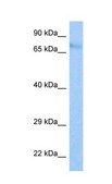 Anti-IFI204 antibody produced in rabbit affinity isolated antibody