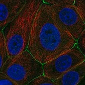 Anti-PAK4 antibody produced in rabbit Prestige Antibodies® Powered by Atlas Antibodies, affinity isolated antibody