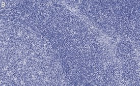 Anti-Caspase-3 Antibody, clone 3J16 , ZooMAb® Rabbit Monoclonal recombinant, expressed in HEK 293 cells