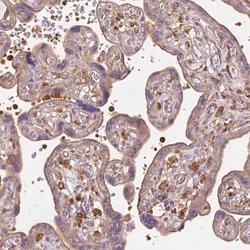 Anti-TBC1D2B antibody produced in rabbit Prestige Antibodies® Powered by Atlas Antibodies, affinity isolated antibody, buffered aqueous glycerol solution