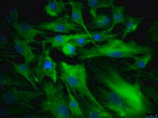 OSUMMER.8 Mouse NRAS-Mutant Melanoma Cell Line