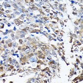 Anti-PGP9.5/UCHL1 antibody produced in rabbit