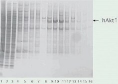 cOmplete™, EDTA-free Protease Inhibitor Cocktail Tablets provided in glass vials