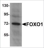 Anti-FOXO1 antibody produced in rabbit affinity isolated antibody, buffered aqueous solution