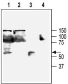 Anti-Potassium Channel KCa3.1 (Intermediate-conductance Ca2+-activated Potassium Channel 4) antibody produced in rabbit affinity isolated antibody, lyophilized powder