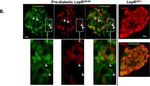 单克隆抗 胰岛素 小鼠抗 clone K36AC10, ascites fluid