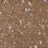 Anti-SPTBN1 antibody produced in rabbit Prestige Antibodies® Powered by Atlas Antibodies, affinity isolated antibody, buffered aqueous glycerol solution