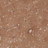 Anti-THY1 antibody produced in rabbit Prestige Antibodies® Powered by Atlas Antibodies, affinity isolated antibody, buffered aqueous glycerol solution